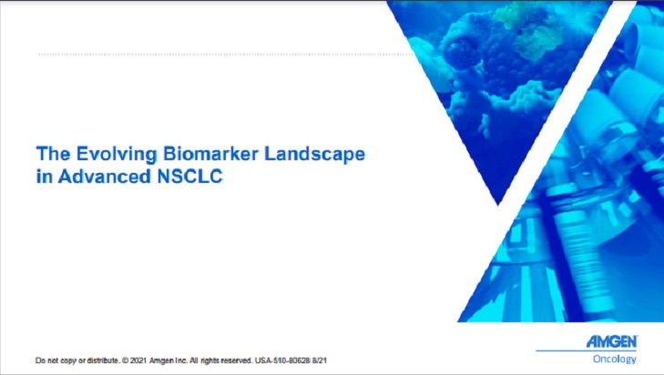 KRAS - A key Oncogenic Driver and Novel Investigational Target in NSCLC