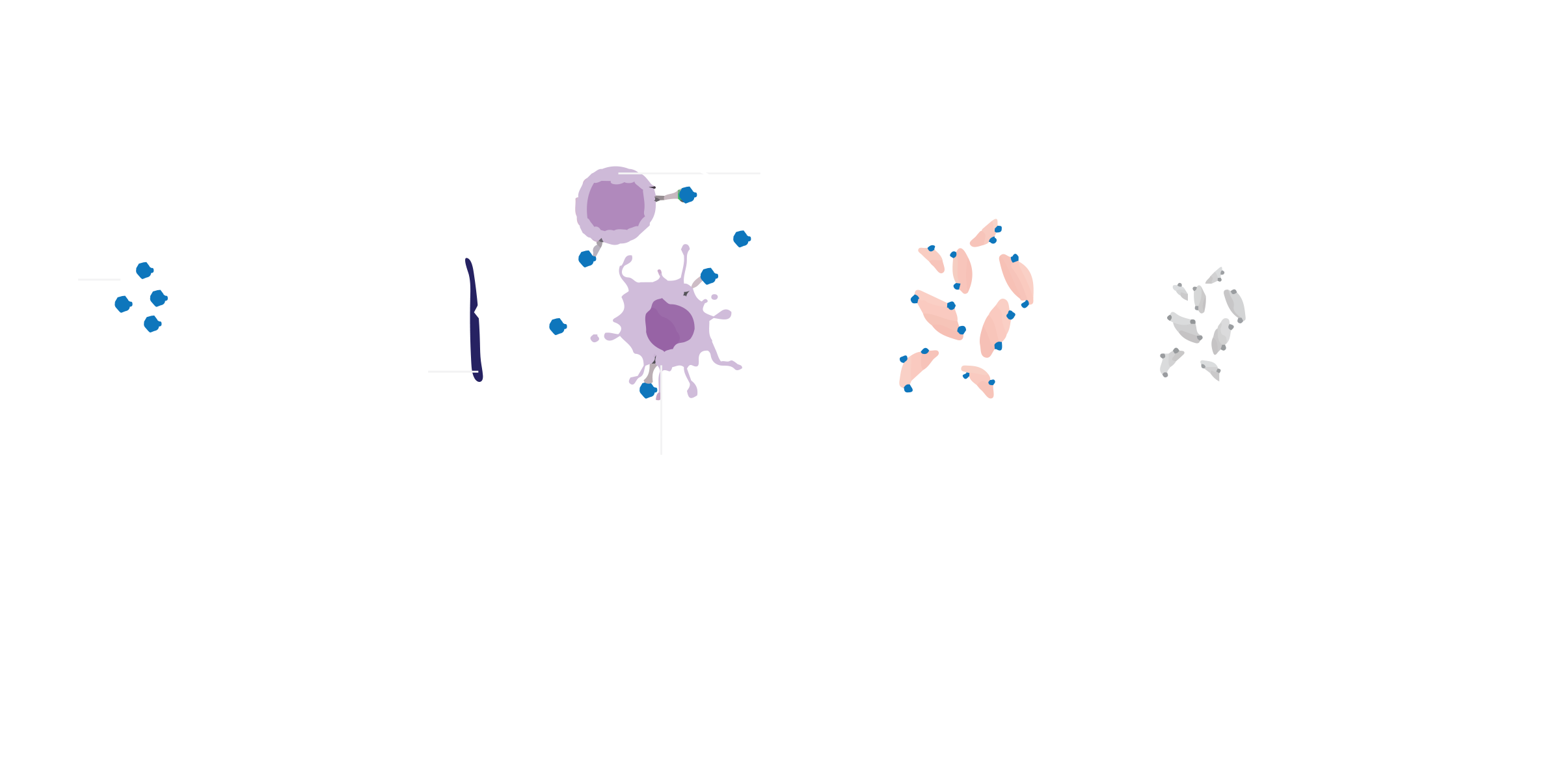 IPT pathophysiology